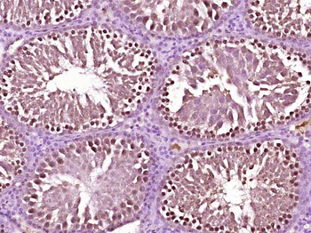 SMARCA4 Rabbit Polyclonal Antibody