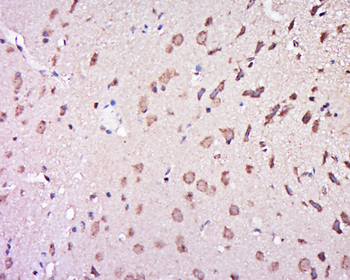 PAK3 Rabbit Polyclonal Antibody