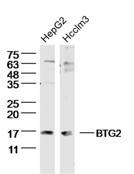 BTG2 Rabbit Polyclonal Antibody