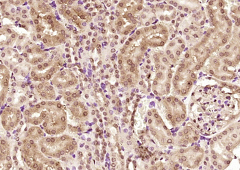 DFFB Rabbit Polyclonal Antibody