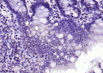 DFFB Rabbit Polyclonal Antibody