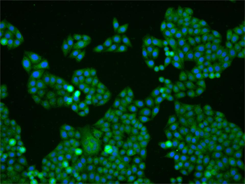 PPP3CA Mouse Polyclonal Antibody
