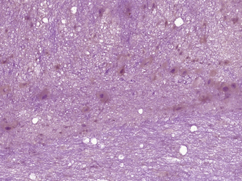 Caldesmon Rabbit Polyclonal Antibody