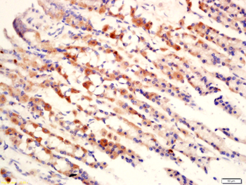 Caldesmon Rabbit Polyclonal Antibody