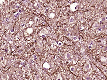 PVRL1 Rabbit Polyclonal Antibody