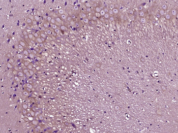 PVRL1 Rabbit Polyclonal Antibody