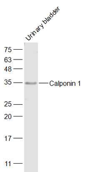 CNN1 Rabbit Polyclonal Antibody