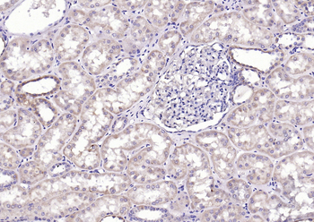 Phospho-CaMKII (Thr287) Rabbit Polyclonal Antibody