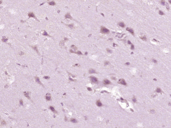 Phospho-CaMKII (Thr287) Rabbit Polyclonal Antibody