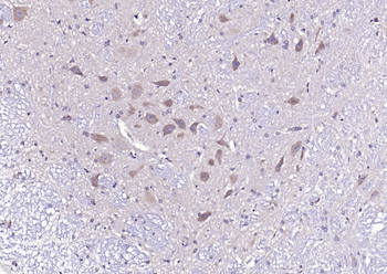 Phospho-CaMKII (Thr287) Rabbit Polyclonal Antibody