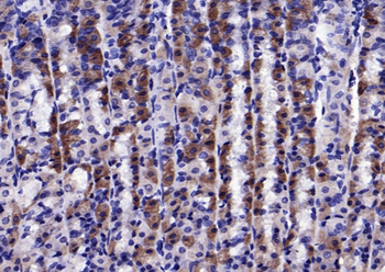 Phospho-CaMKII (Thr287) Rabbit Polyclonal Antibody