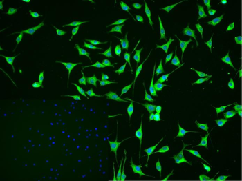 CAMK2A + CAMK2B + CAMK2D Rabbit Polyclonal Antibody