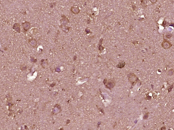 CAMK2A + CAMK2B + CAMK2D Rabbit Polyclonal Antibody