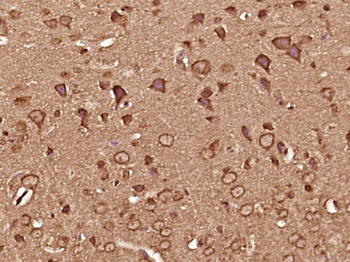 CAMK2A + CAMK2B + CAMK2D Rabbit Polyclonal Antibody