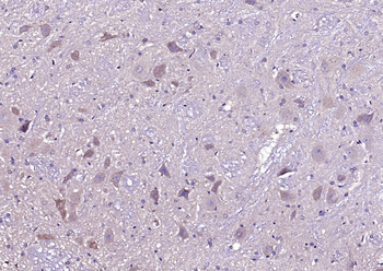 CAMK2A + CAMK2B + CAMK2D Rabbit Polyclonal Antibody