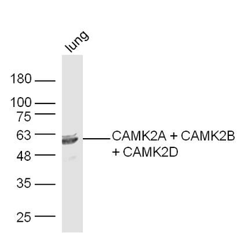 CAMK2A + CAMK2B + CAMK2D Rabbit Polyclonal Antibody