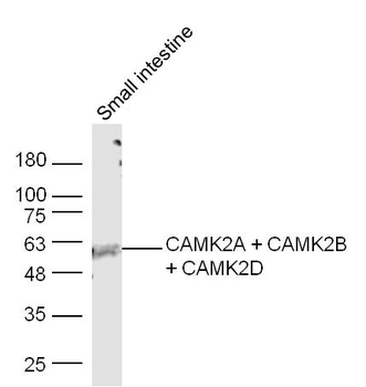 CAMK2A + CAMK2B + CAMK2D Rabbit Polyclonal Antibody