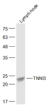 Cardiac Troponin I/TNNC1 Rabbit Polyclonal Antibody