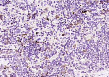 CA I Rabbit Polyclonal Antibody