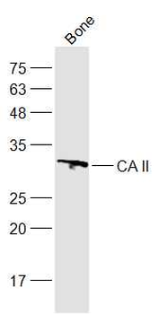 CA II Rabbit Polyclonal Antibody