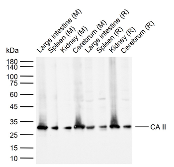 CA II Rabbit Polyclonal Antibody