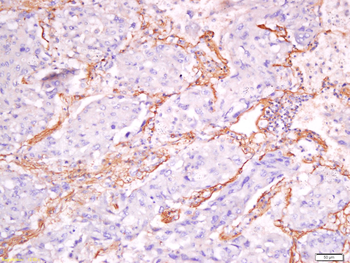 Exportin-2 Rabbit Polyclonal Antibody