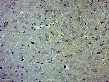 Caspase-1 P10 Rabbit Polyclonal Antibody