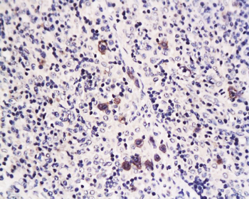 Caspase-1 P10 Rabbit Polyclonal Antibody