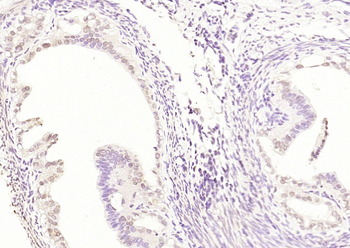 Caspase-12 Rabbit Polyclonal Antibody