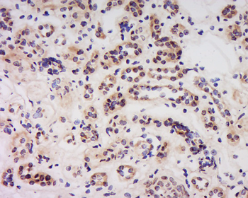Caspase-6 subunit p18 Rabbit Polyclonal Antibody