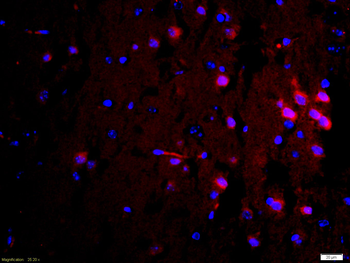 Caspase-6 subunit p18 Rabbit Polyclonal Antibody