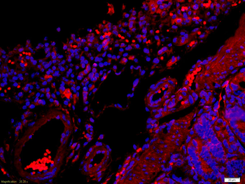 Caspase-6 subunit p18 Rabbit Polyclonal Antibody