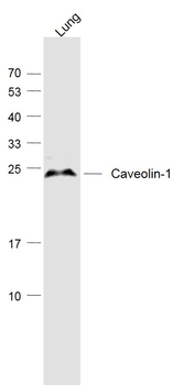 Caveolin-1 Rabbit Polyclonal Antibody