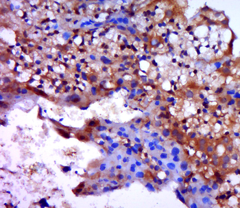 Beta catenin Rabbit Polyclonal Antibody
