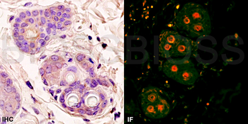 Beta catenin Rabbit Polyclonal Antibody