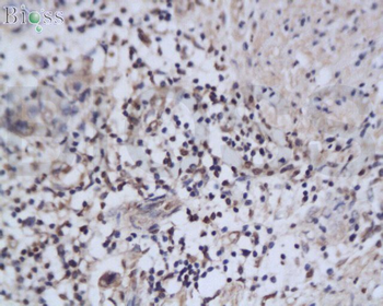 NAIF1 Rabbit Polyclonal Antibody