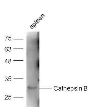 Cathepsin B Rabbit Polyclonal Antibody