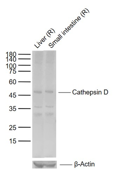 Cathepsin D Rabbit Polyclonal Antibody