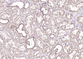Cathepsin L Rabbit Polyclonal Antibody