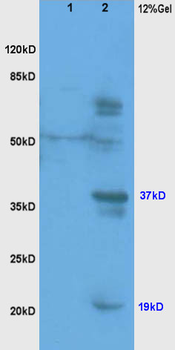 Cathepsin L Rabbit Polyclonal Antibody