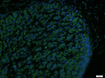 ERAS Rabbit Polyclonal Antibody (FITC)