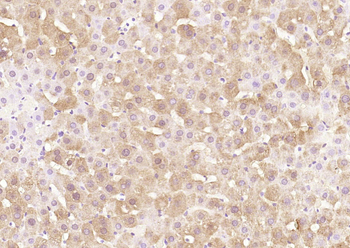 Ceramide glucosyltransferase Rabbit Polyclonal Antibody