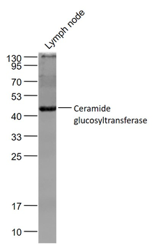 Ceramide glucosyltransferase Rabbit Polyclonal Antibody