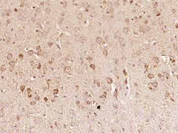 RANTES Rabbit Polyclonal Antibody