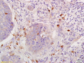 RANTES Rabbit Polyclonal Antibody