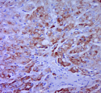 CCL20 Rabbit Polyclonal Antibody