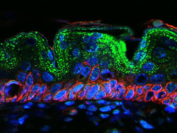 CCL11 Rabbit Polyclonal Antibody
