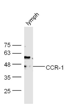 CCR-1/CD191 Rabbit Polyclonal Antibody