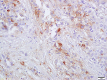 CCR-2 Rabbit Polyclonal Antibody