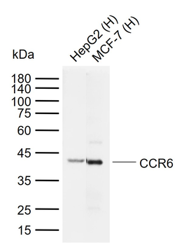 CCR6 Rabbit Polyclonal Antibody